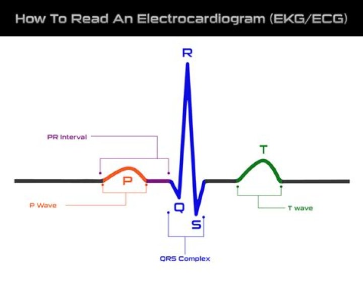 What does the electrocardiogram represent?